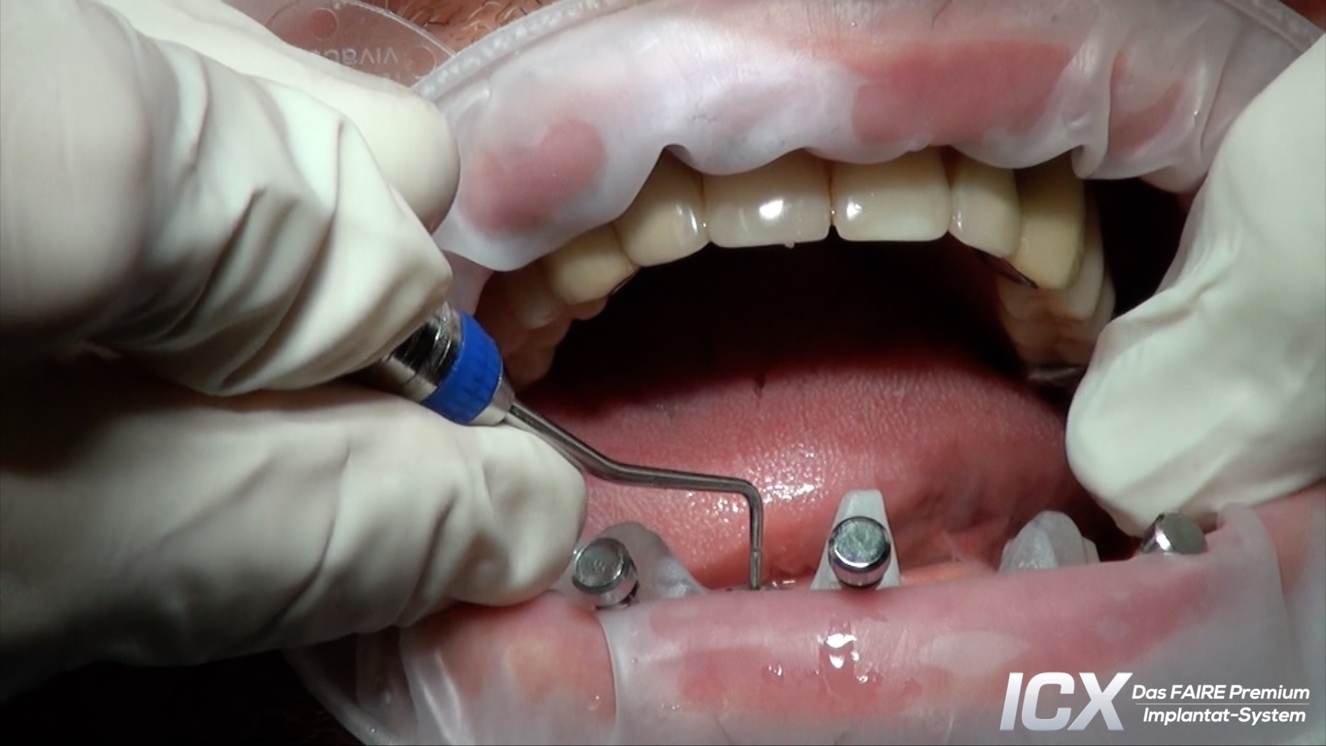 Clinical Case 1